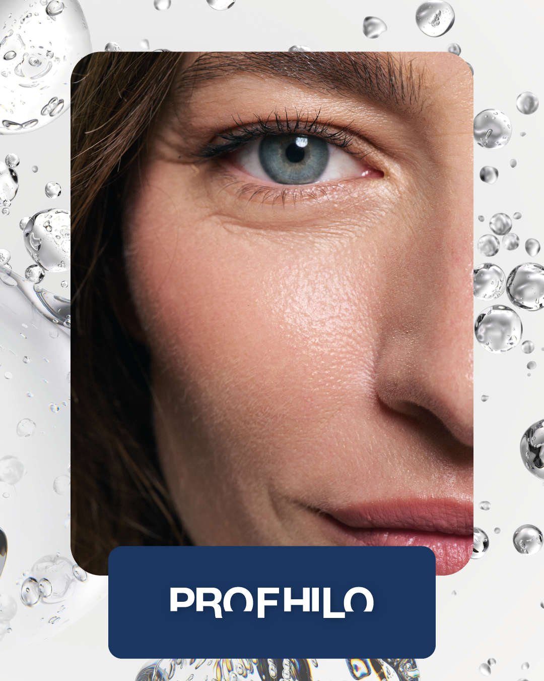 PROFHILO-Apr-24-2026-06-01-47-9374-PM