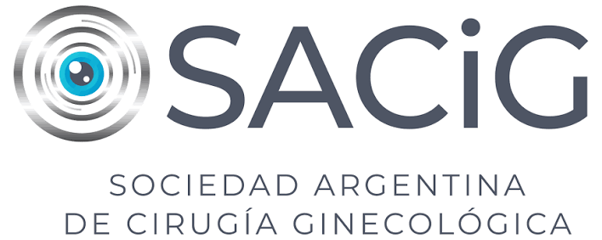SACIG