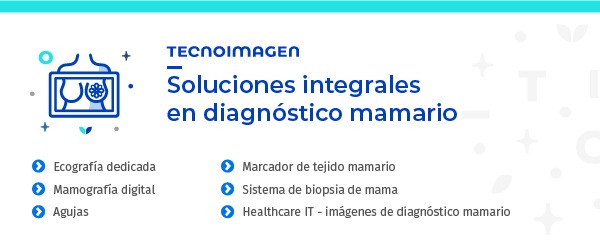 soluciones integrales en diagnóstico mamario